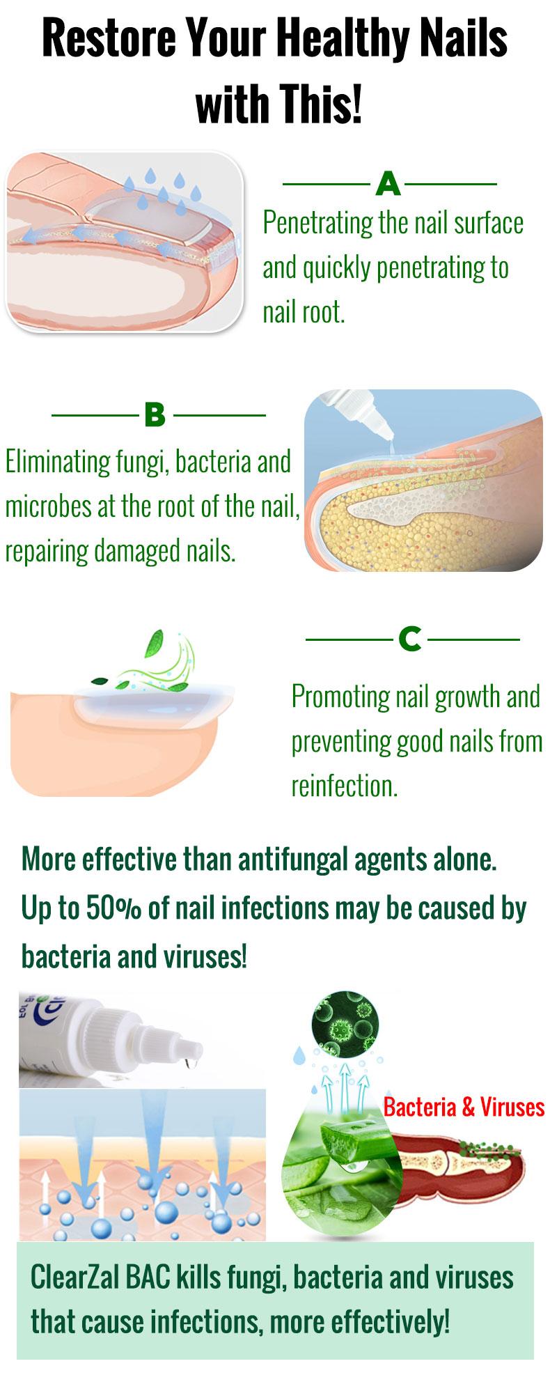 ClearZal Antimicrobial BAC Nail Solution Fungal Nail Treatment 1 Ounce Kills Fungus, Bacteria and  Viruses