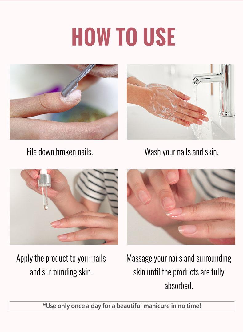 ClearZal Nail and Cuticle Serum, Hydrates Conditions Repairs - 1 oz Nail Nutrition Repair damaged nails  For Weak, Thin, Soft, Peeling Nails, Enriched with Tea Tree Oil, Vitamin E,  Avocado Oil,Reinforces, Thickens Nails, Promotes Strength and Flexibilit